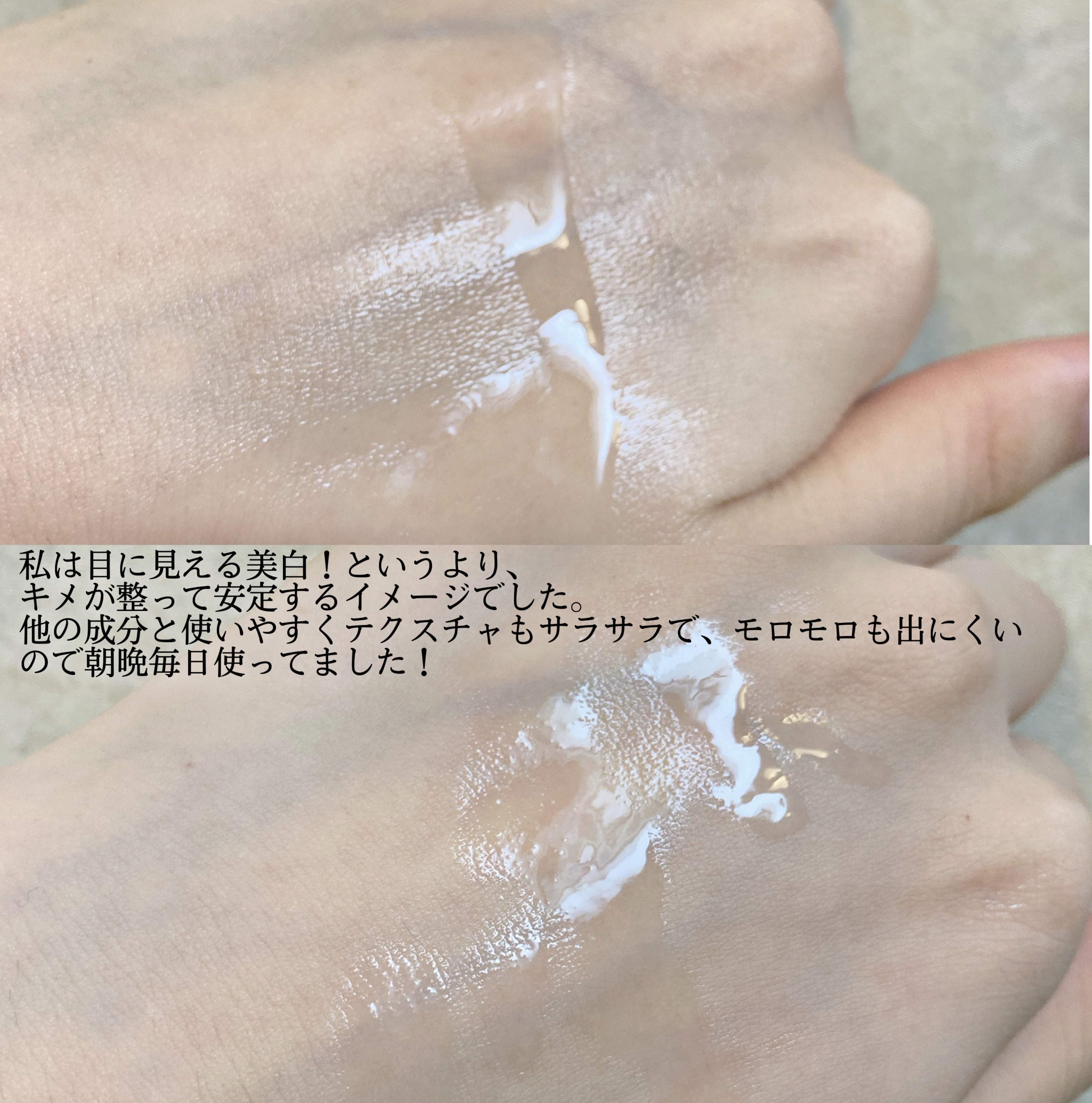 ガラクナイアシン2.0エッセンス/manyo/美容液を使ったクチコミ（3枚目）