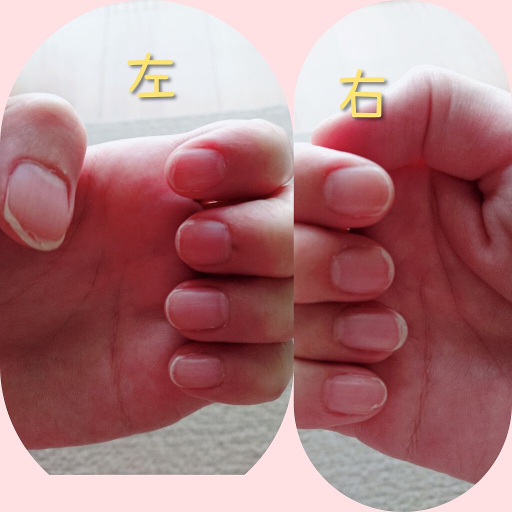 ハンドベール プレミアムリッチネイル/メンソレータム/ネイルオイル・トリートメントを使ったクチコミ（3枚目）