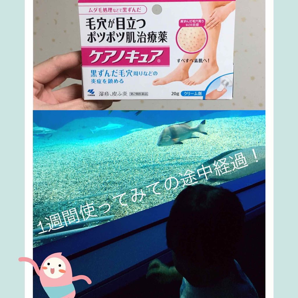 ケアノキュア（医薬品）/小林製薬/その他を使ったクチコミ（1枚目）