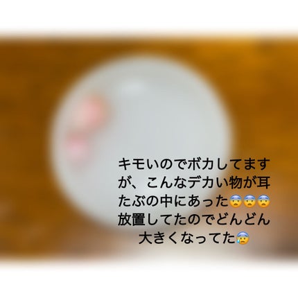 みや on LIPS 「こんばんは〜!!遅くなりましたが、あけましておめでとうございま..」(4枚目)