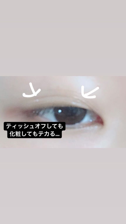 オリシキ アイリッドスキンフィルム		/D-UP/二重まぶた用アイテムを使ったクチコミ(3枚目)