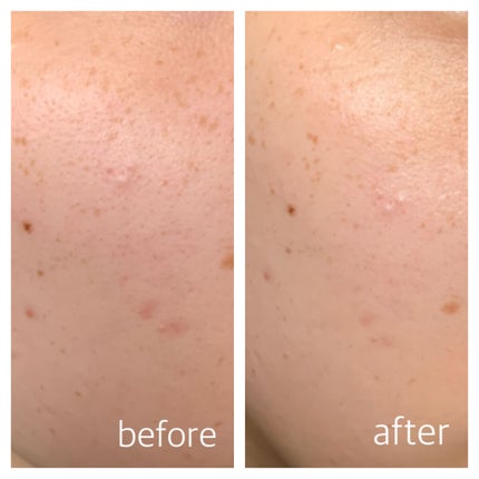 UVイデア XL プロテクショントーンアップ ローズ/ラ ロッシュ ポゼ/日焼け止めクリームを使ったクチコミ(3枚目)