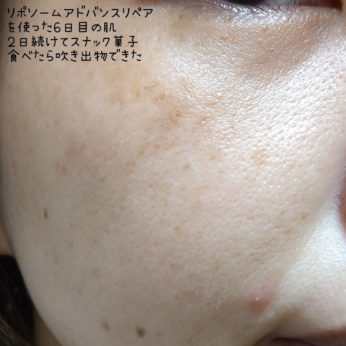 リポソーム アドバンスト リペアセラム/DECORTÉ/美容液を使ったクチコミ(8枚目)