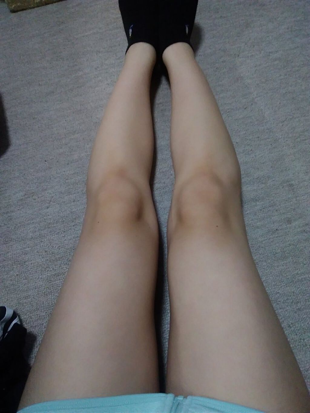 寝ながらメディキュット スパッツ 骨盤テーピング/メディキュット/着圧ソックス・レギンスを使ったクチコミ（1枚目）