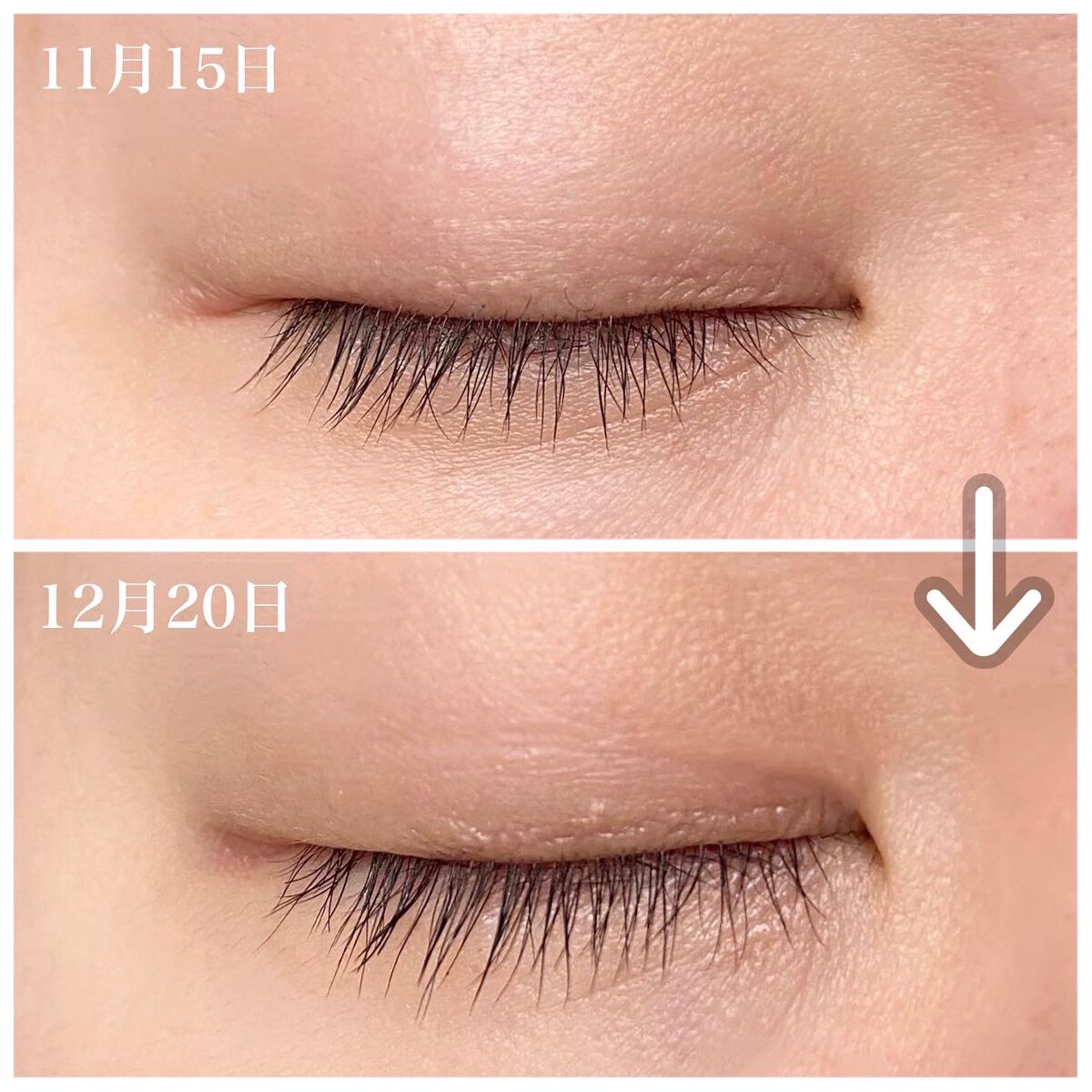 エターナルアイラッシュ/リュバンブラン/まつげ美容液を使ったクチコミ(2枚目)