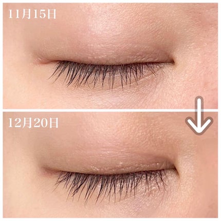 エターナルアイラッシュ/リュバンブラン/まつげ美容液を使ったクチコミ(2枚目)