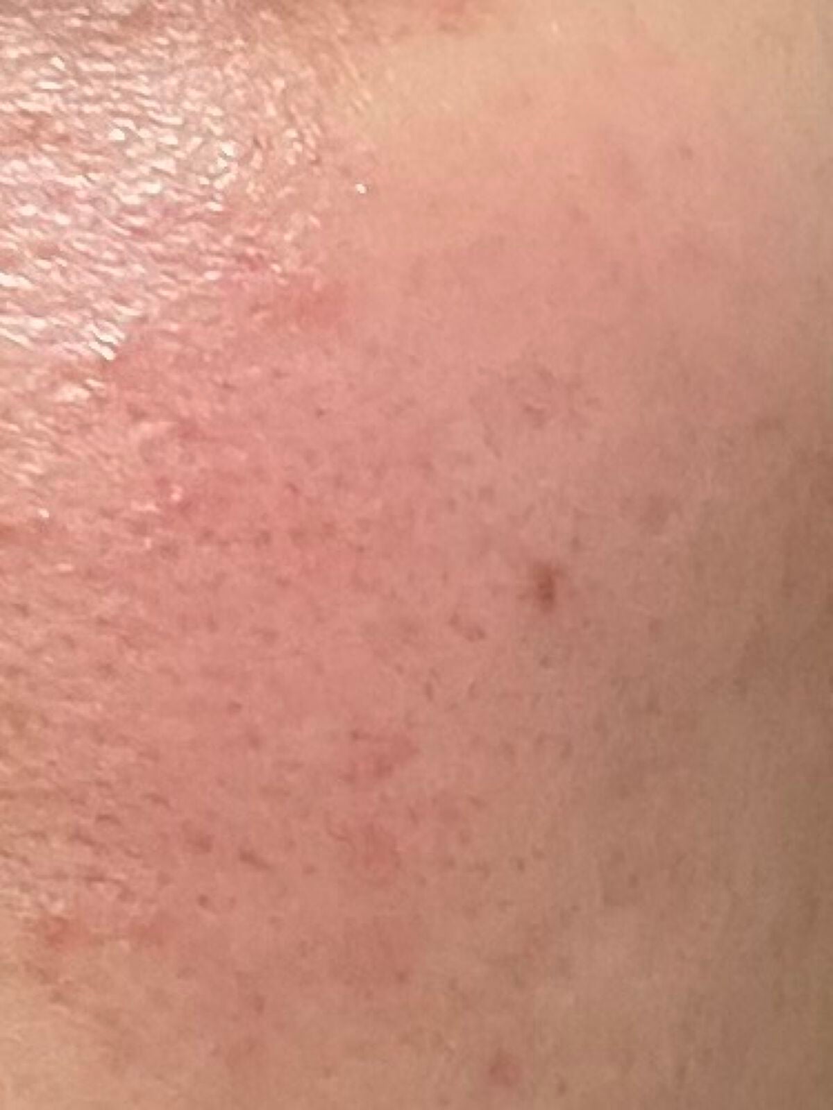 アクメディカ 薬用 UVミルク/ナリスアップ/日焼け止めミルクを使ったクチコミ(3枚目)