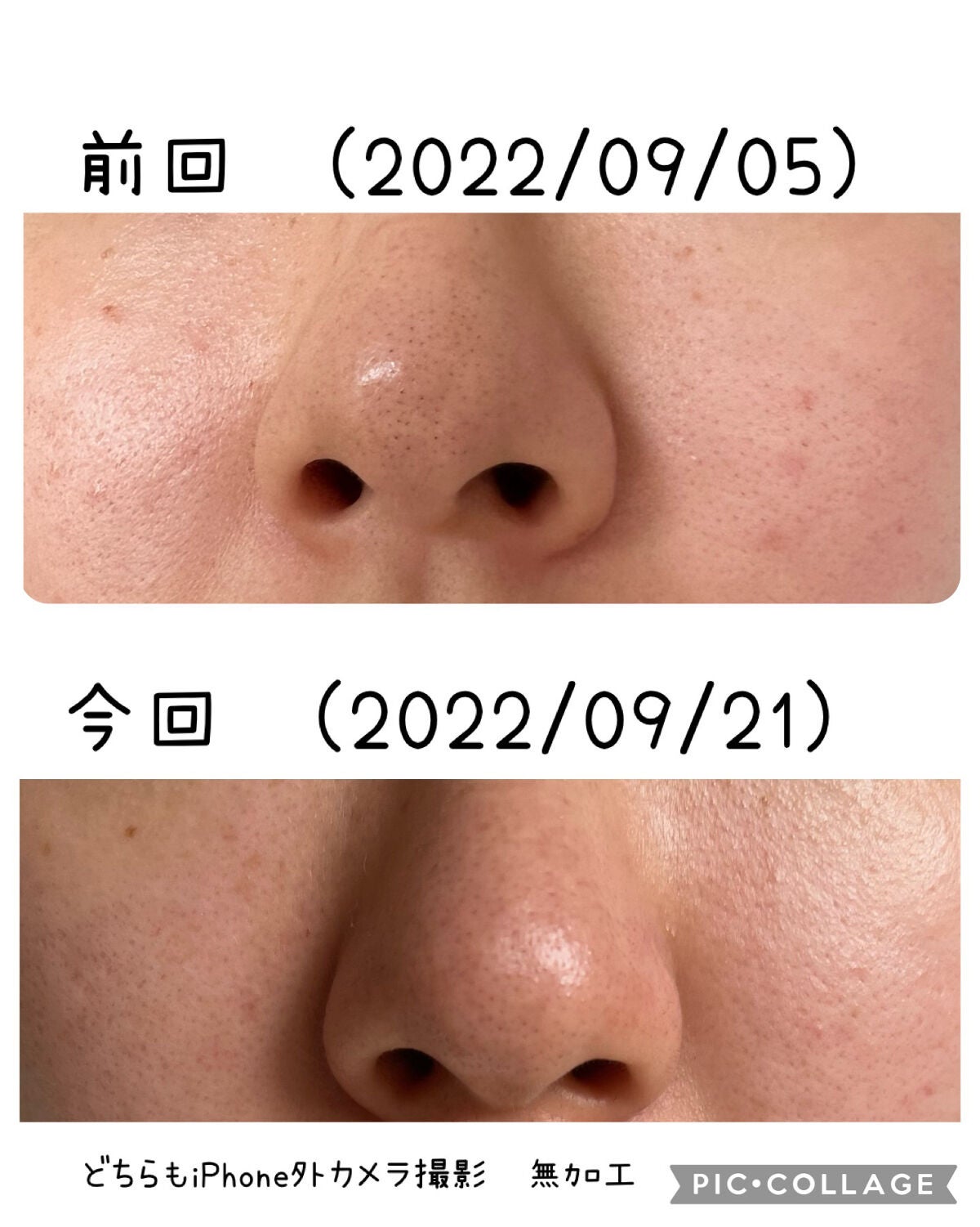 潤浸保湿 化粧水 II しっとり/キュレル/化粧水を使ったクチコミ(2枚目)