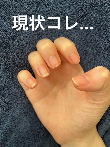 ネイルトリートメントオイル/カントリー&ストリーム/ネイルオイル・トリートメントを使ったクチコミ(3枚目)