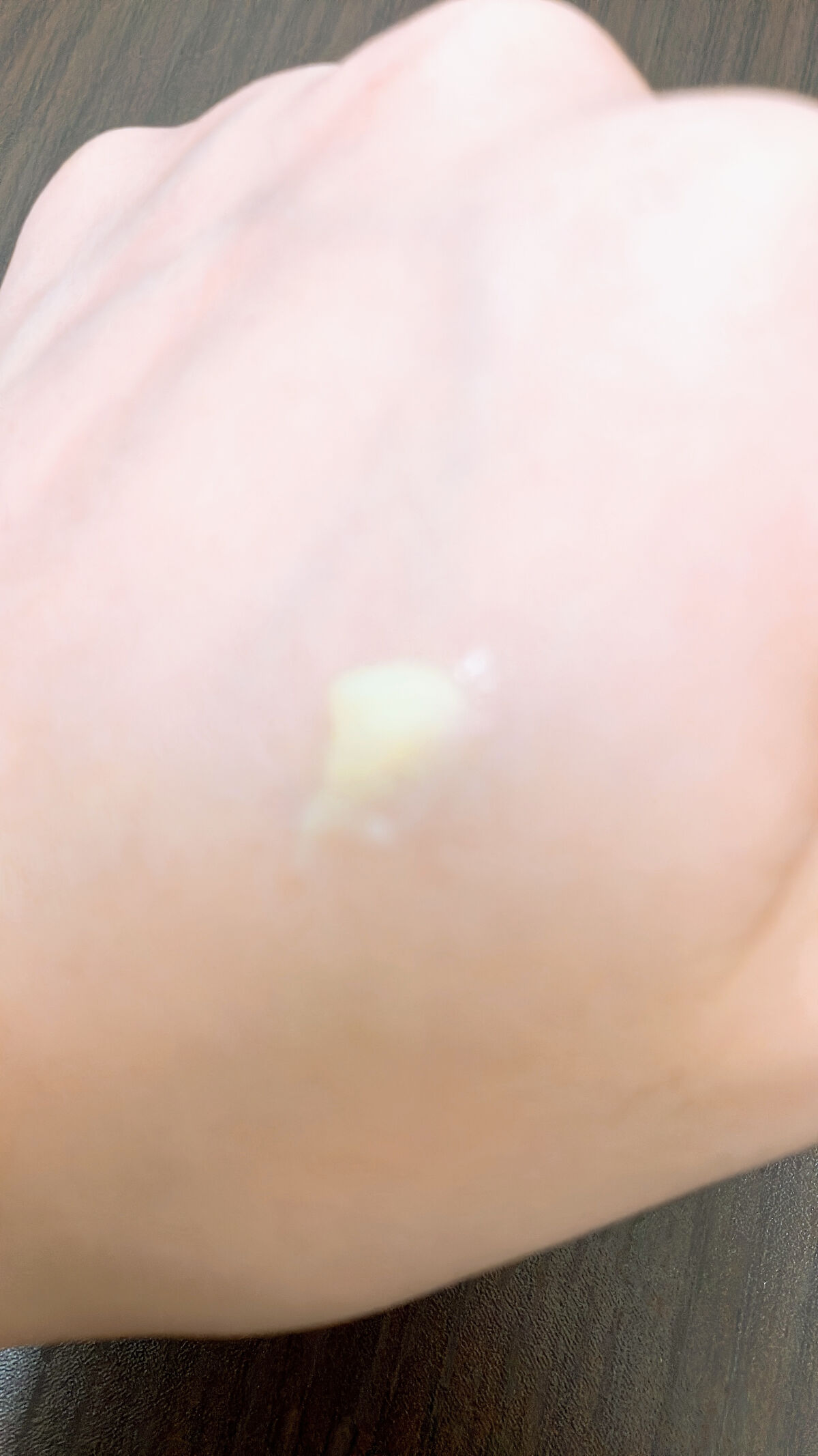 キスミー薬用ハンドクリーム/キスミー 薬用シリーズ/ハンドクリームを使ったクチコミ（3枚目）