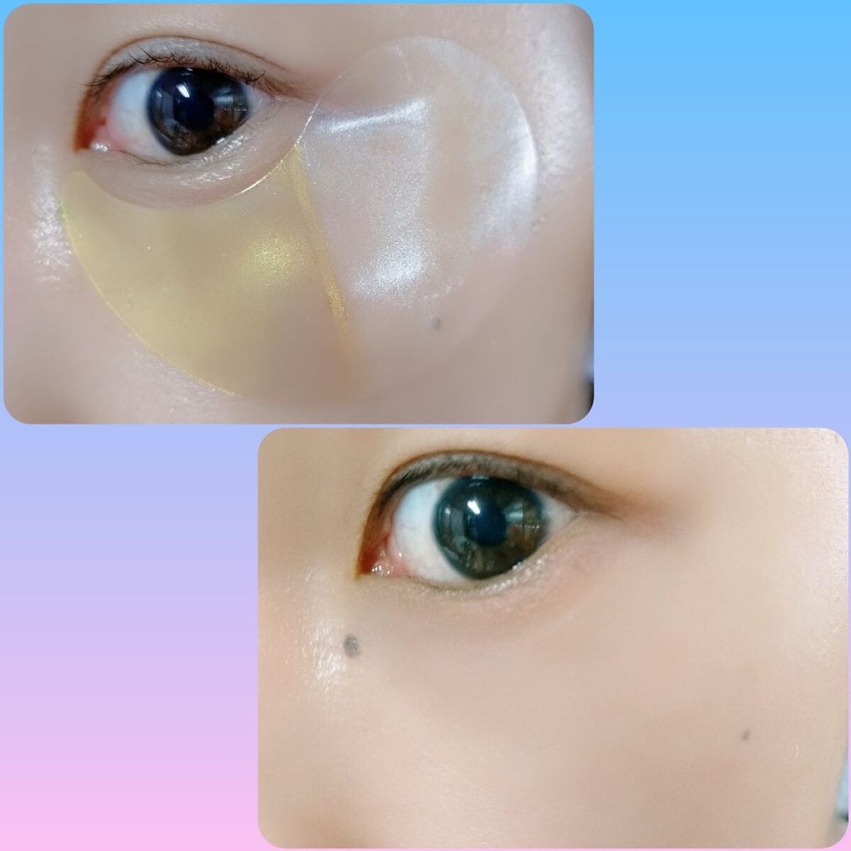 GOLD COLLAGEN DUAL EYE PATCH/SNP/アイケア・アイクリームを使ったクチコミ(4枚目)