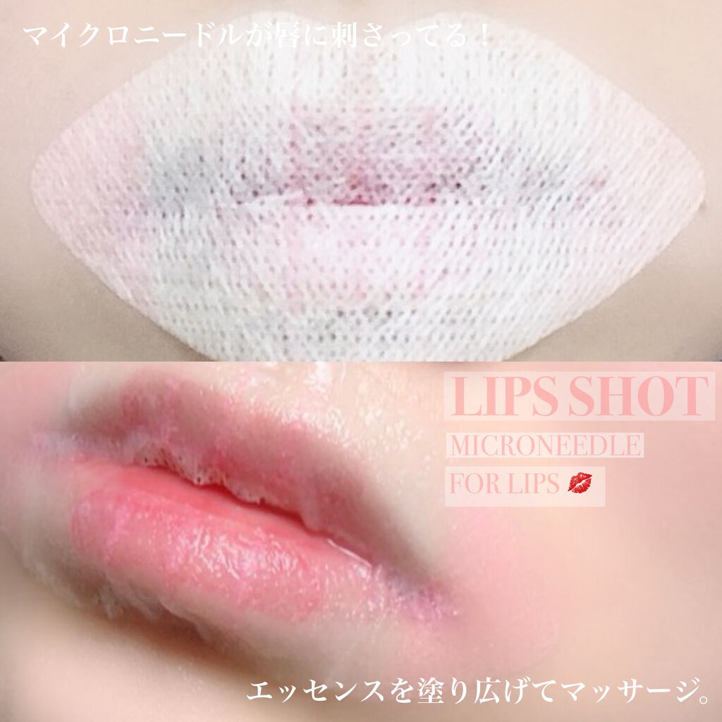 LIPS SHOT/MOTTO LAB./リップマスクを使ったクチコミ（1枚目）
