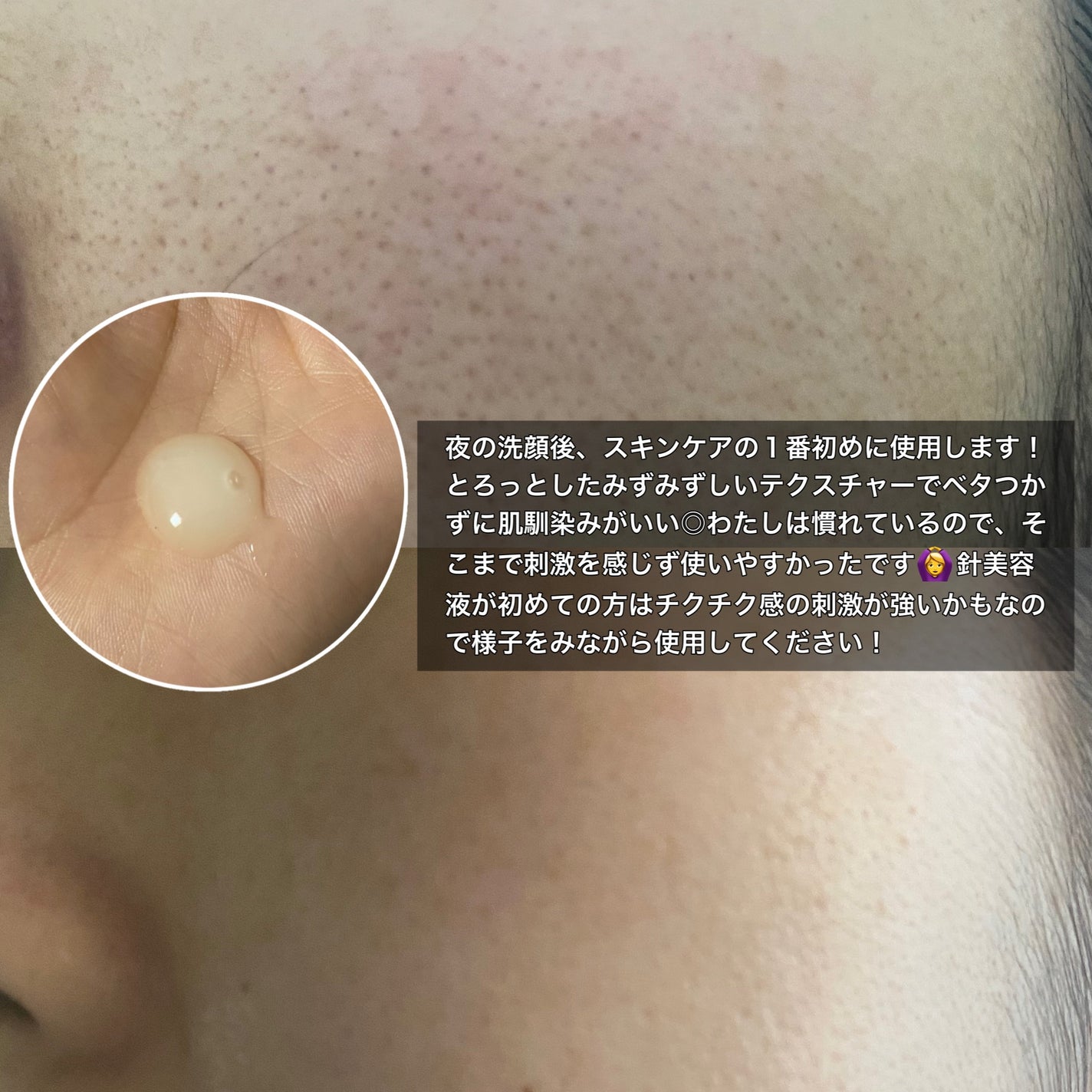 PDRNショット675/COSNORI/美容液を使ったクチコミ(3枚目)