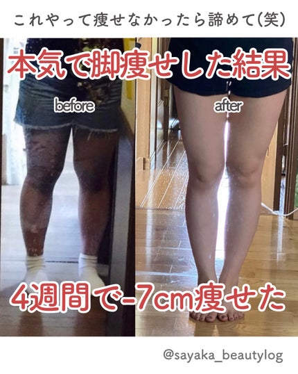 寝ながらメディキュット ロング/メディキュット/着圧ソックス・レギンスを使ったクチコミ(1枚目)