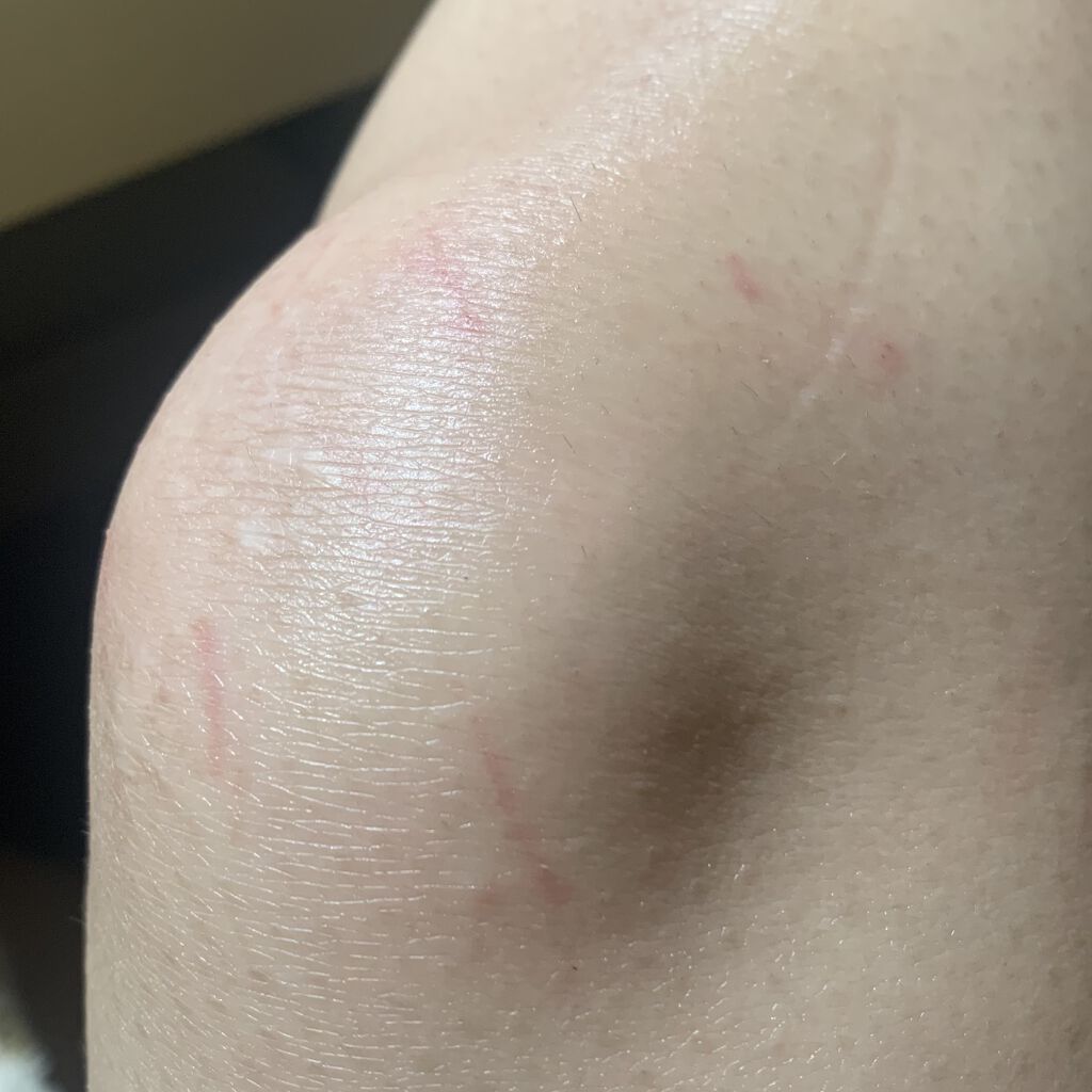 bi-hada ompa L ホルダー替刃2個付/貝印/シェーバーを使ったクチコミ（2枚目）