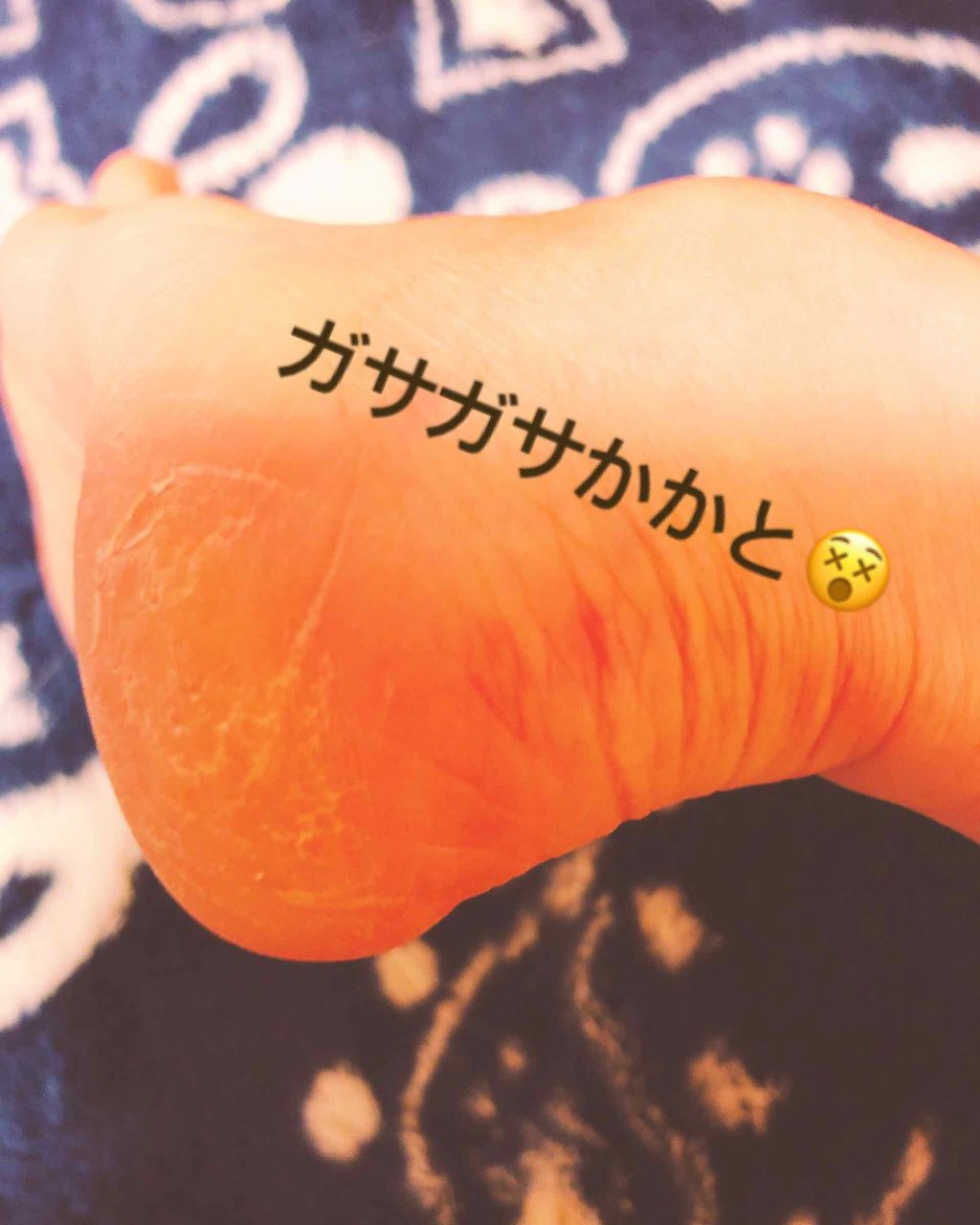 ニベアクリーム/ニベア/ボディクリームを使ったクチコミ(1枚目)