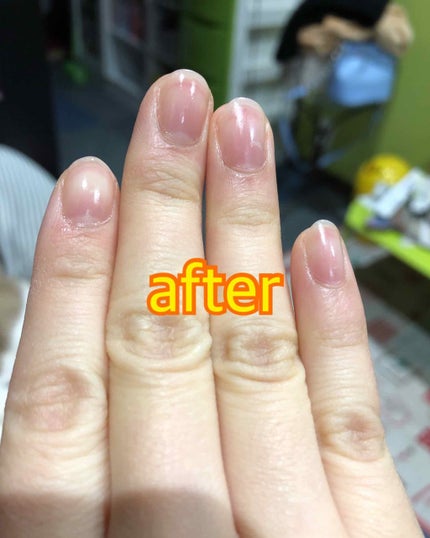 エテュセ クイックケアコート/ettusais/ネイルオイル・トリートメントを使ったクチコミ(3枚目)