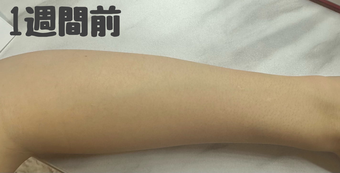 モイスチュアマイルドホワイト パーフェクトエッセンス/モイスチュアマイルド ホワイト/オールインワン化粧品を使ったクチコミ(2枚目)