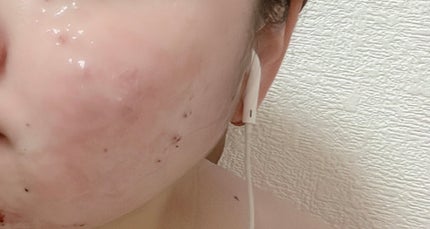 アクアバムモデリングマスク/23years old/洗い流すパック・マスクを使ったクチコミ(3枚目)