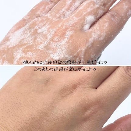 ボディスクラブ/médelle/ボディスクラブを使ったクチコミ(5枚目)