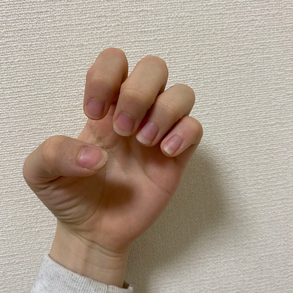 エテュセ クイックケアコート/ettusais/ネイルオイル・トリートメントを使ったクチコミ(1枚目)