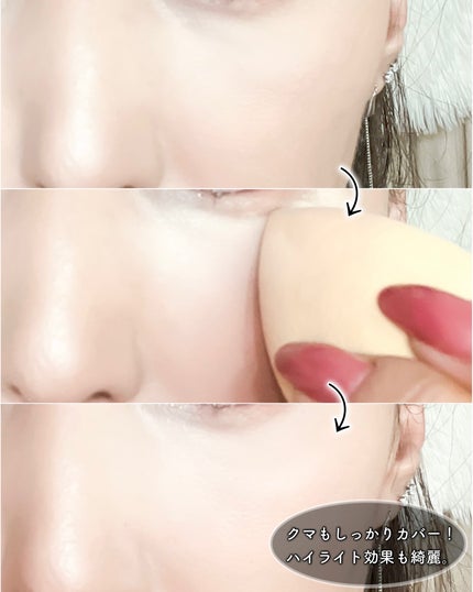 ダーマシンコンシーラー/23years old/リキッドコンシーラーを使ったクチコミ(5枚目)