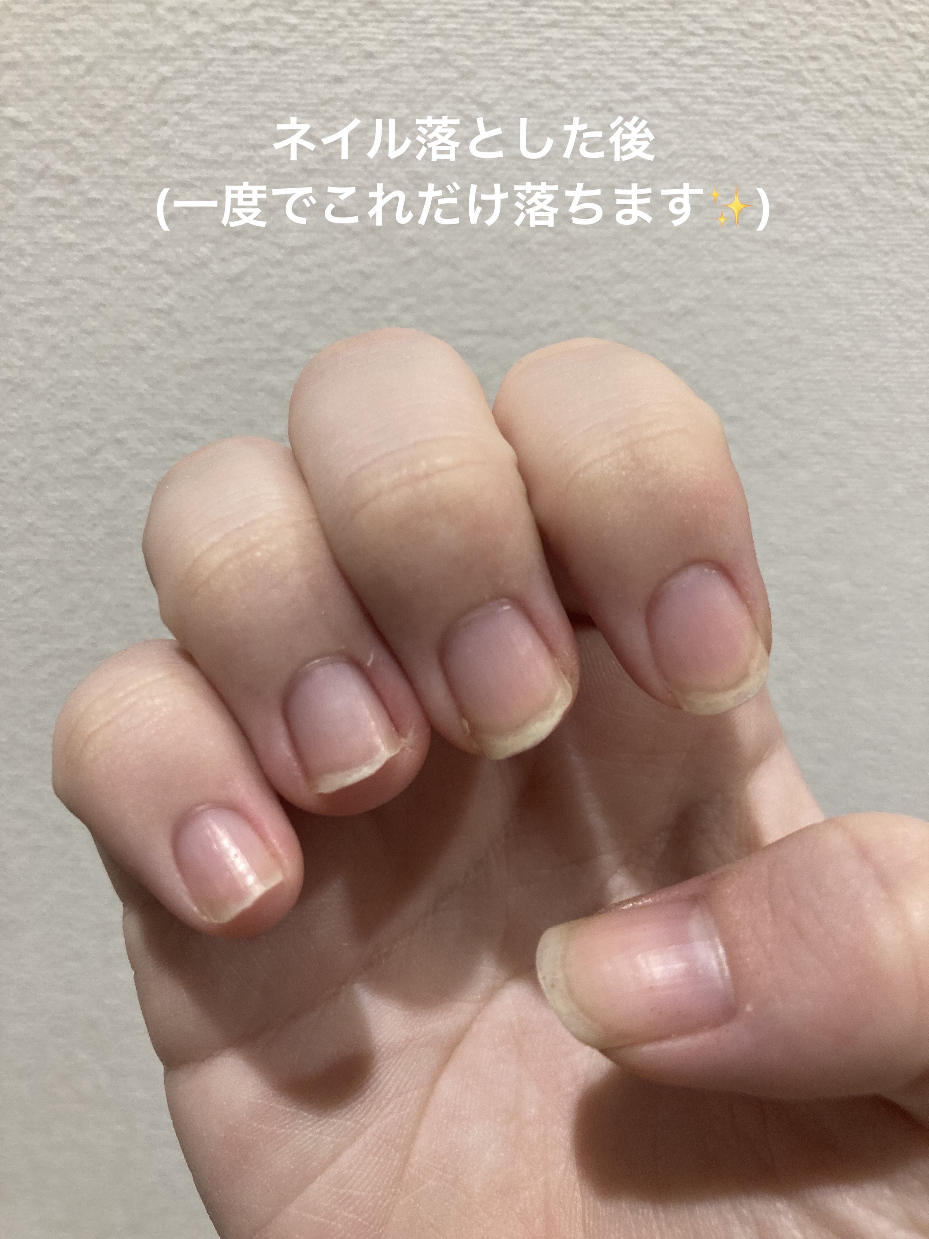 除光液/ちふれ/除光液を使ったクチコミ（3枚目）