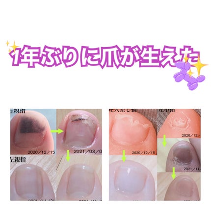 ネイルエンビー/O・P・I/ネイルオイル・トリートメントを使ったクチコミ(1枚目)