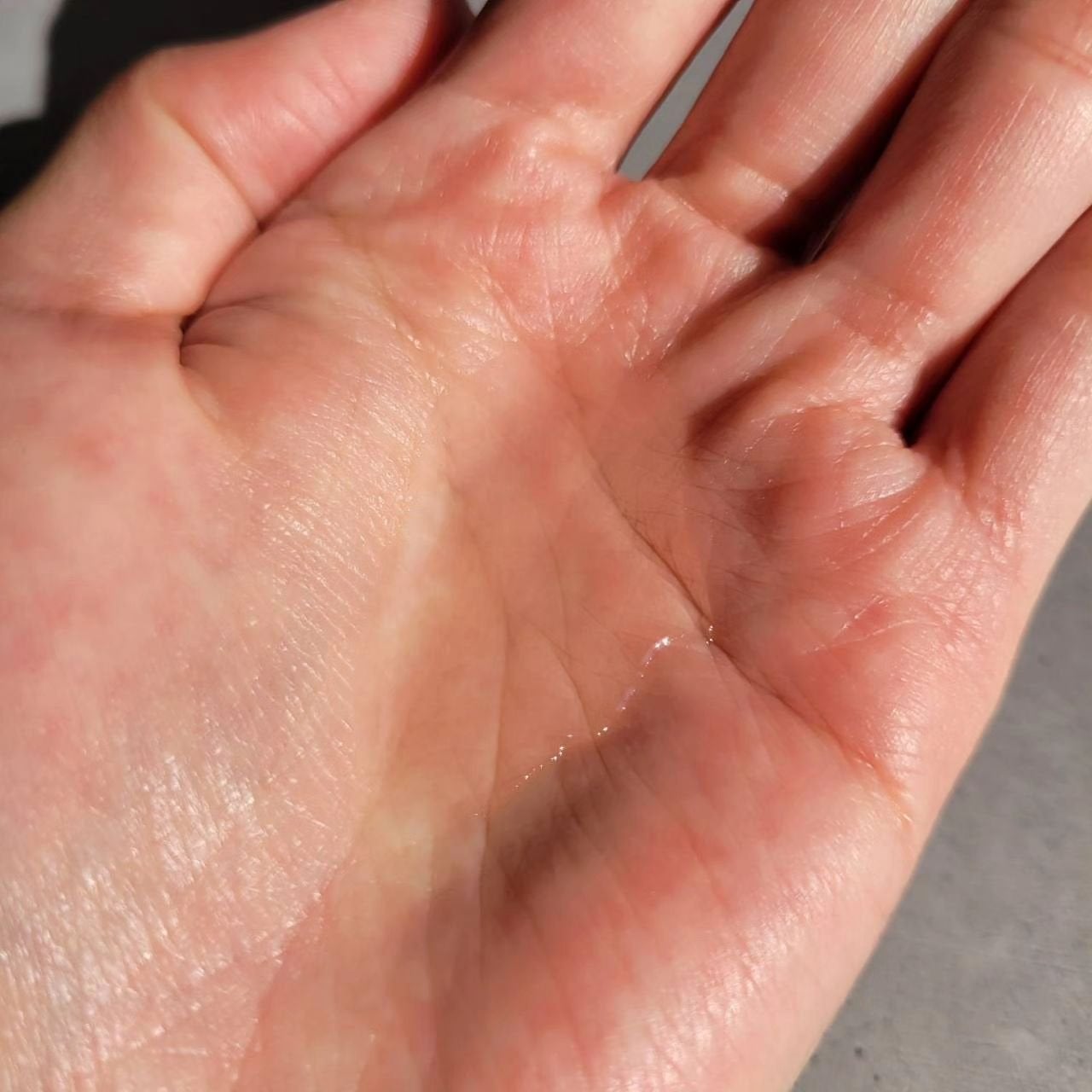 レッドブレミッシュ クリアスージングトナー/Dr.G/化粧水を使ったクチコミ(5枚目)