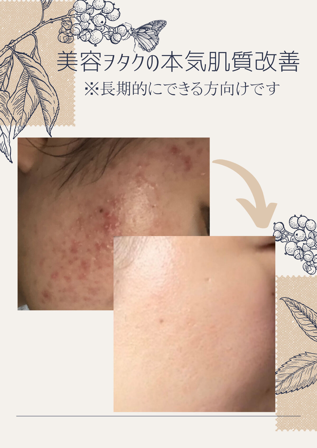 白潤プレミアム薬用浸透美白化粧水/肌ラボ/化粧水を使ったクチコミ（1枚目）