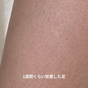 FASIZ HAIR REMOVAL 家庭用脱毛器/FASIZ/家庭用脱毛器を使ったクチコミ（2枚目）