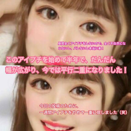 のびーるアイテープ(絆創膏タイプ、レギュラー)/DAISO/二重まぶた用アイテムを使ったクチコミ(4枚目)