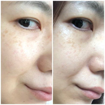 多機能温冷美顔器/ANLAN/美顔器・マッサージを使ったクチコミ(9枚目)