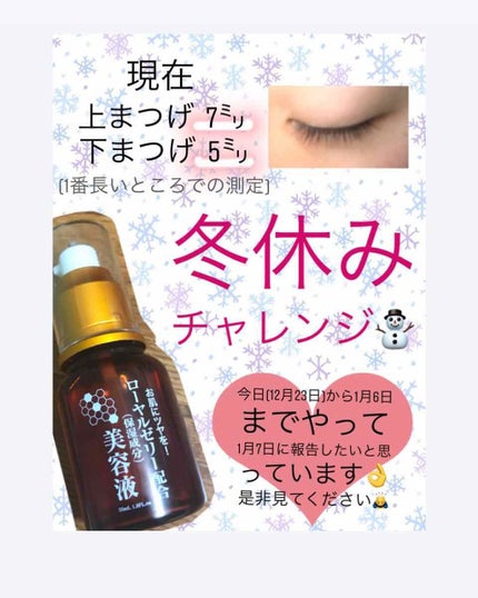 ローヤルゼリー配合 栄養ローション/DAISO/美容液を使ったクチコミ(1枚目)