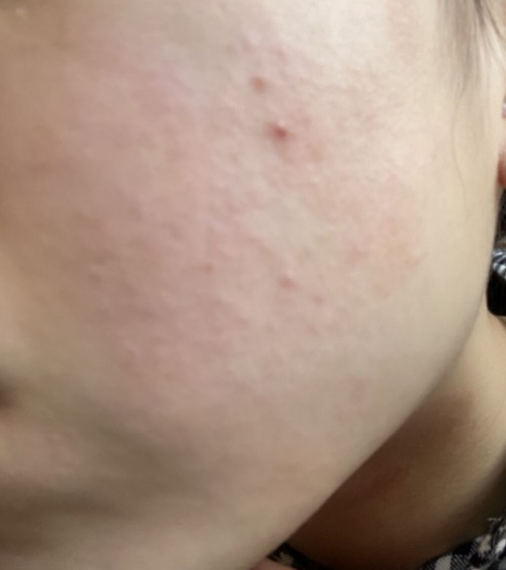 ハトムギ化粧水(ナチュリエ スキンコンディショナー R )/ナチュリエ/化粧水を使ったクチコミ（2枚目）