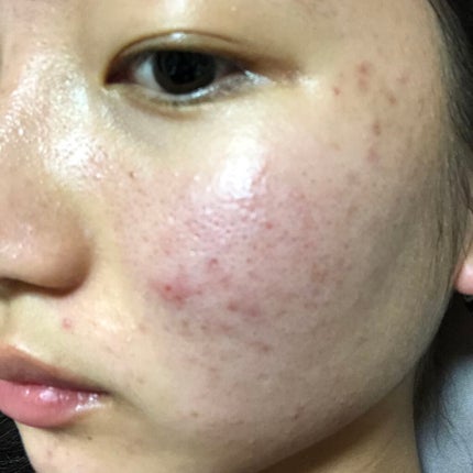 を使ったクチコミ(1枚目)