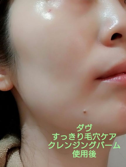 ダヴ すっきり毛穴ケアクレンジングバーム/ダヴ/クレンジングバームを使ったクチコミ(3枚目)
