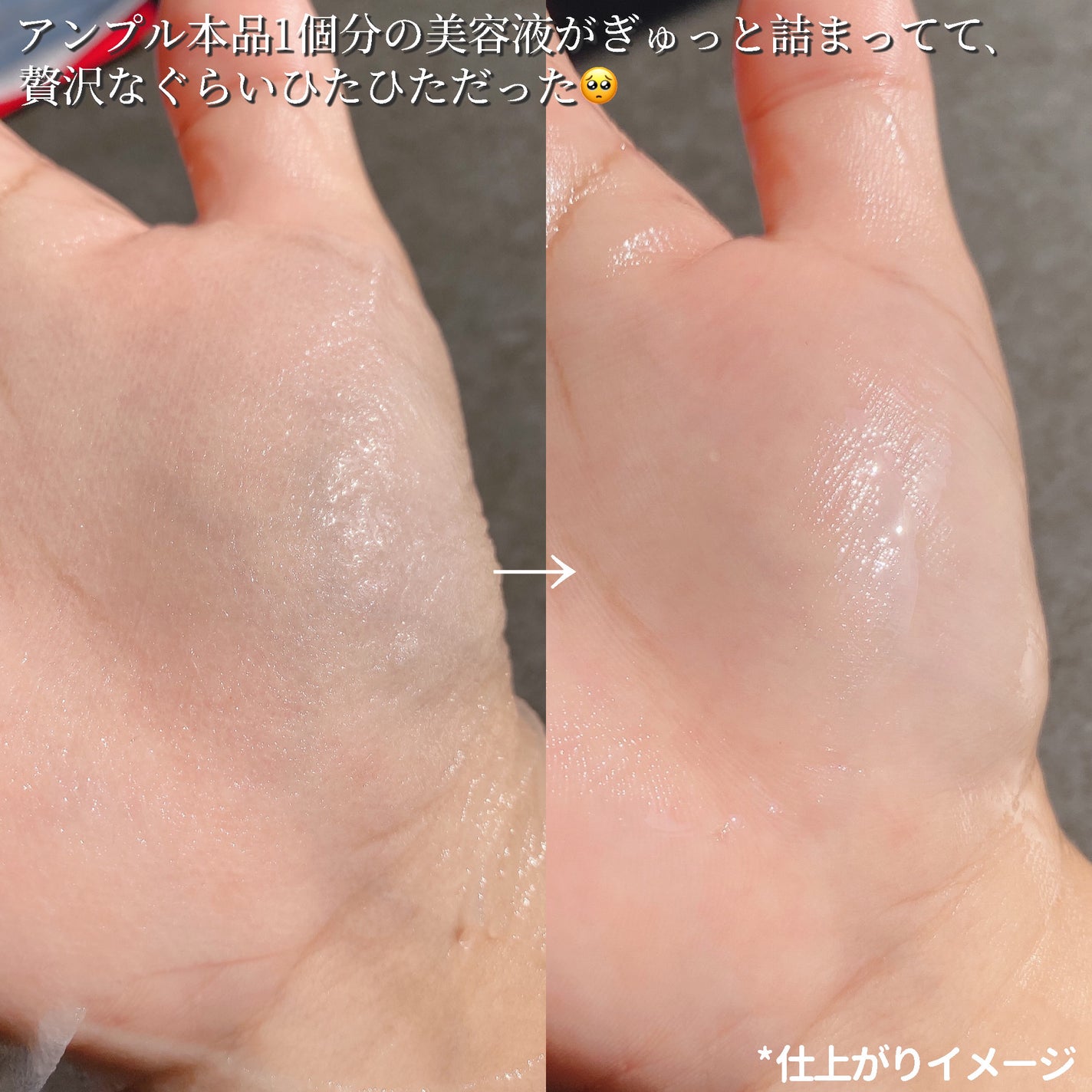 レッド ラクト コラーゲン フォアリフティング マスク/MEDIPEEL/シートマスク・パックを使ったクチコミ(3枚目)