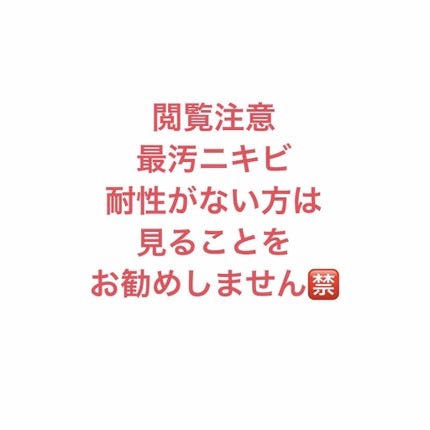 ビーソフテン ローション(医薬品)/持田製薬/その他を使ったクチコミ(1枚目)