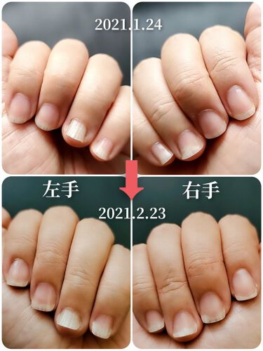 クイックケアコート Ettusaisを使った口コミ 爪甲剥離症の育爪記録以前の投稿はこちらに By かぴめろん 訪問率低下 深謝 乾燥肌 40代後半 Lips