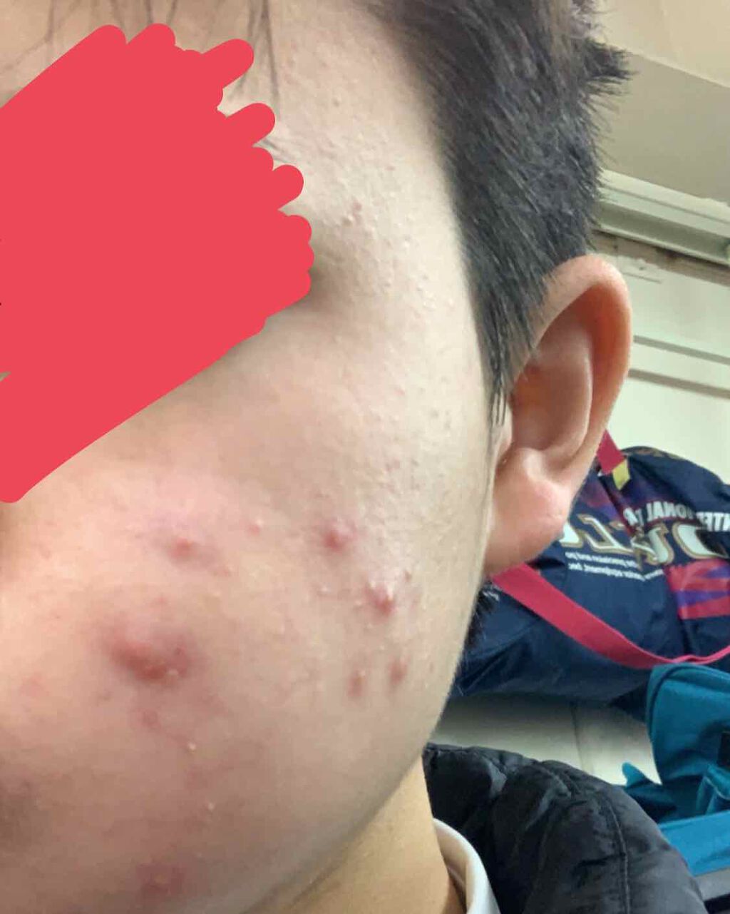 DHC ビタミンＣハードカプセル/DHC/美容サプリメントを使ったクチコミ（1枚目）