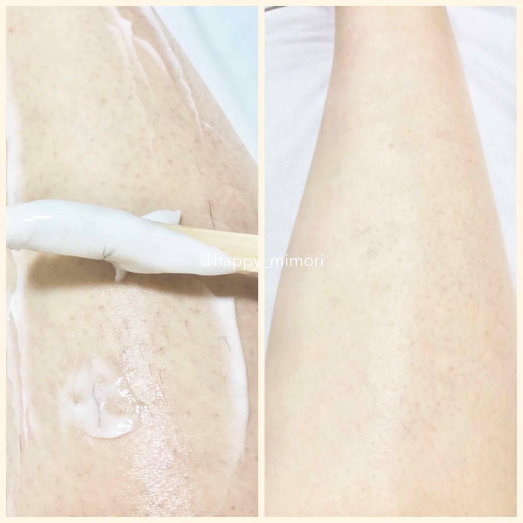deleMO/deleMO/除毛クリームを使ったクチコミ(3枚目)