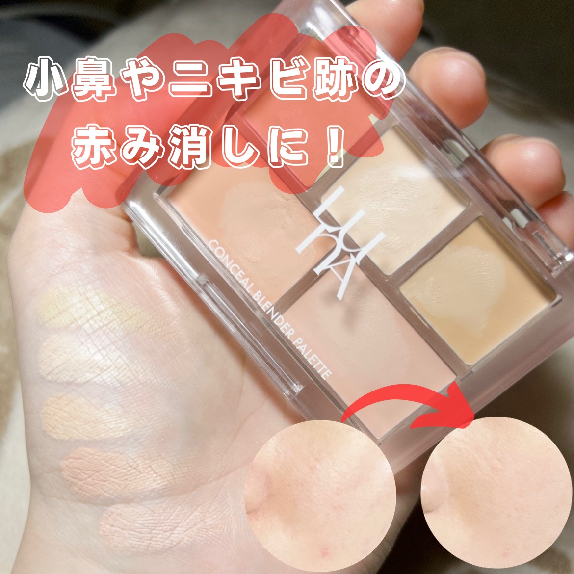 コンシールブレンダーパレット/LUNA/パレットコンシーラーを使ったクチコミ（1枚目）