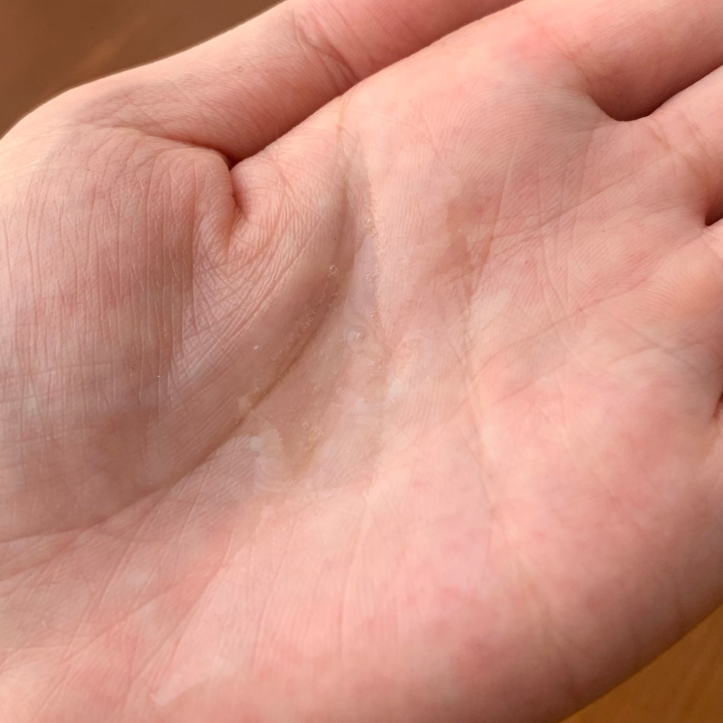 ホワイトショット CXS/ホワイトショット/美容液を使ったクチコミ(3枚目)