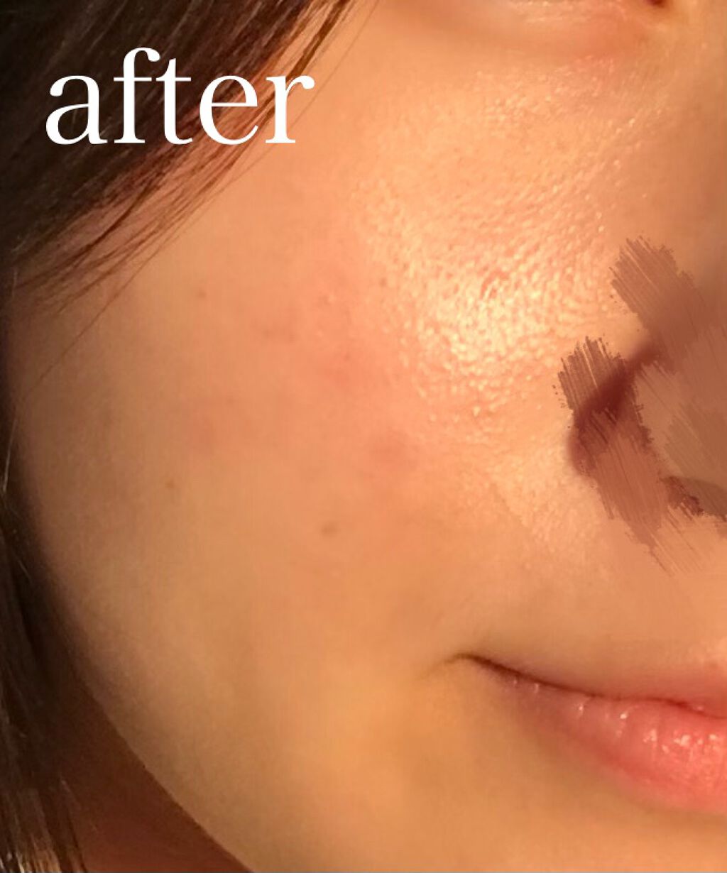 モイストバランス ローション/ACSEINE/化粧水を使ったクチコミ(4枚目)