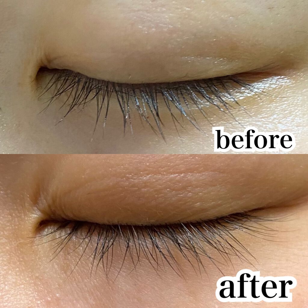 グロウアイラッシュセラム/フェース/まつげ美容液を使ったクチコミ（3枚目）