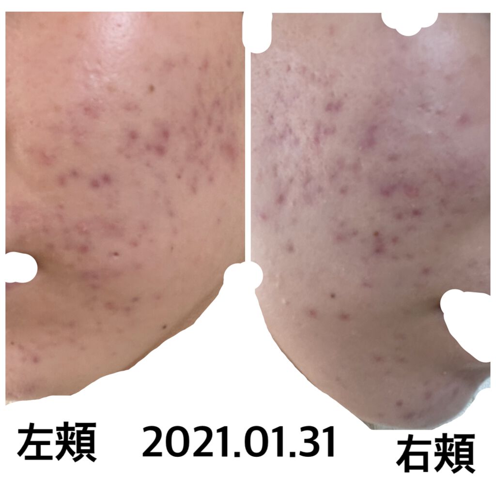 【旧品】マシュマロフィニッシュパウダー/キャンメイク/プレストパウダーを使ったクチコミ（1枚目）