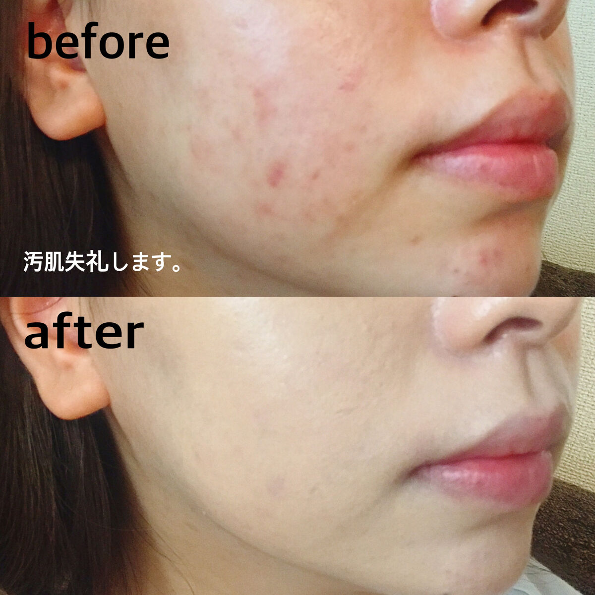 マスク フィット レッド クッション/TIRTIR(ティルティル)/クッションファンデーションを使ったクチコミ（3枚目）