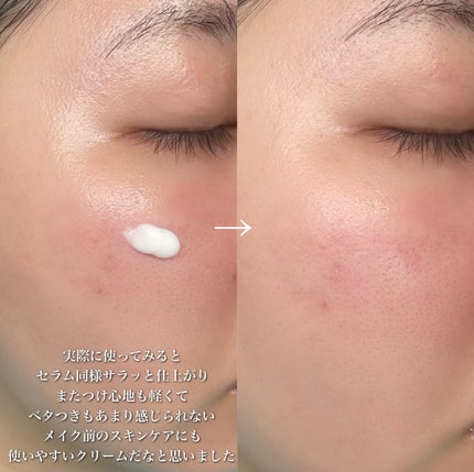 ノスカナイン トラブル セラム/FATION/美容液を使ったクチコミ(9枚目)