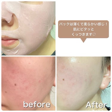 ドクタージャルト Dr.jart Brightening Mask/Dr.Jart＋/シートマスク・パックを使ったクチコミ（2枚目）